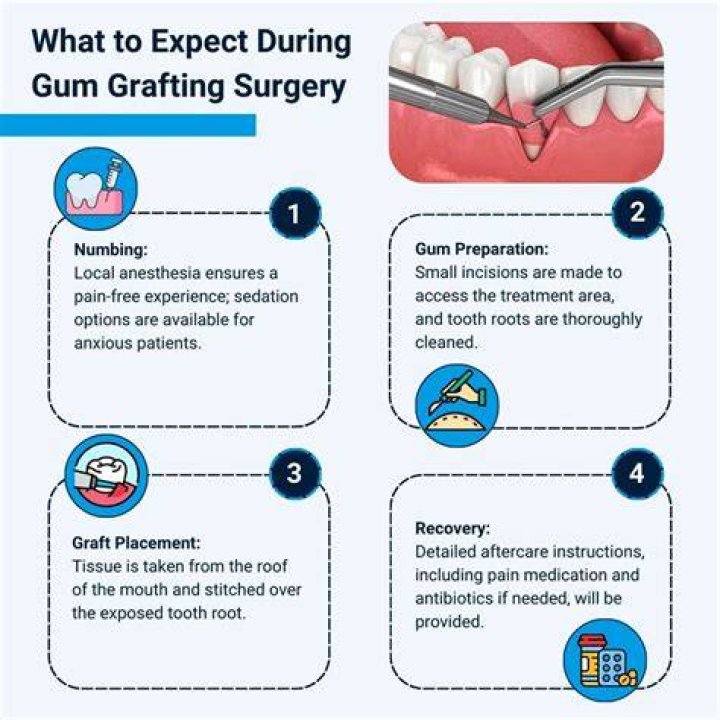 Are antibiotics necessary after gum graft?