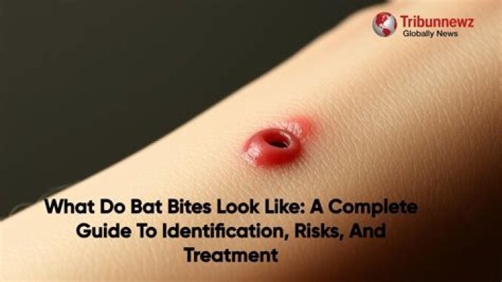Are bat bites painful?