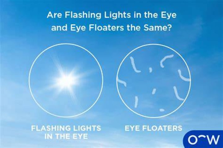 Are eye flashes obvious?