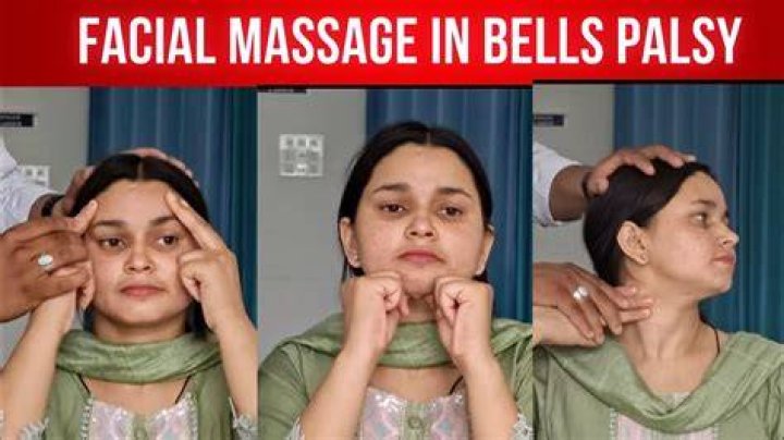 Are facial massages good for Bell's palsy?