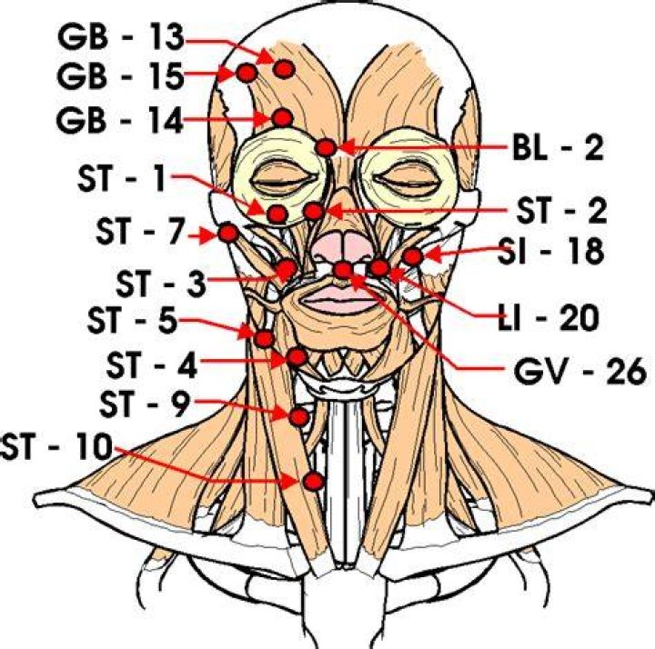 Are nerve strikes real?
