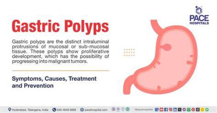 Are polyps in the stomach common?