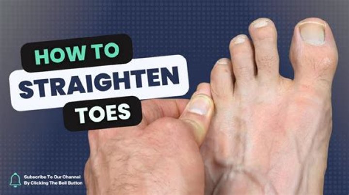 Are toes meant to be straight?