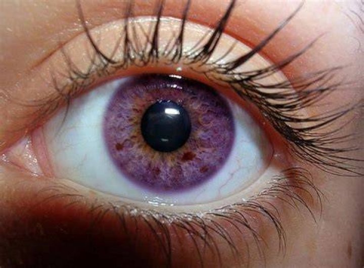Are violet eyes real?
