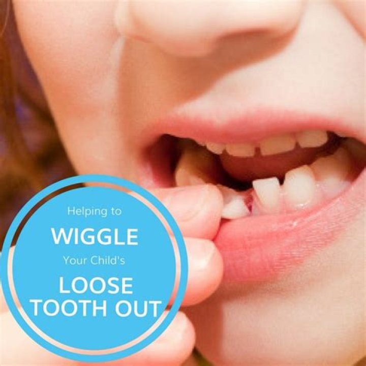 Are your teeth supposed to wiggle?