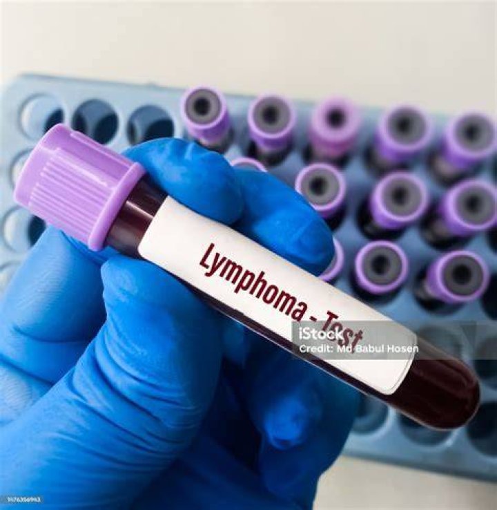 Can a blood test detect lymphoma?