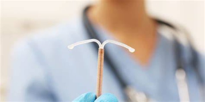 Can a copper IUD cause hair loss?
