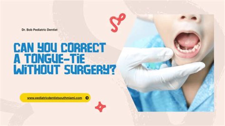 Can a dentist cut a tongue-tie?