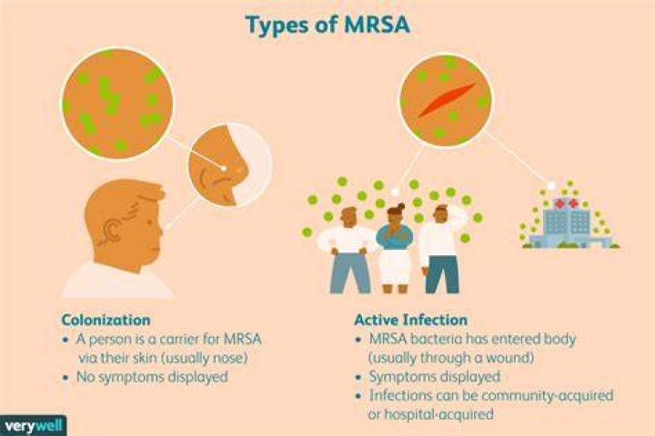 Can a healthy person die from MRSA?