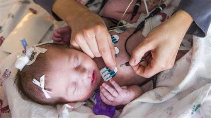 Can a pediatric patient receive an EKG?