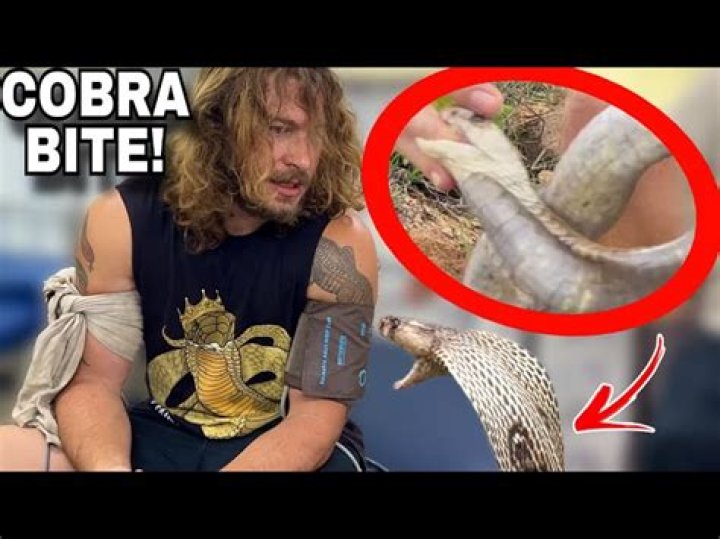 Can a person survive a cobra bite?