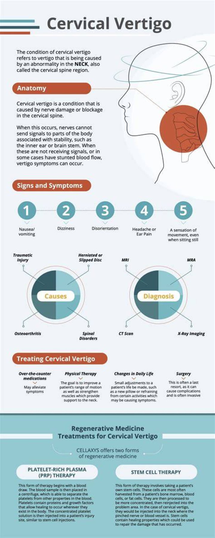 Can a stiff neck cause vertigo?