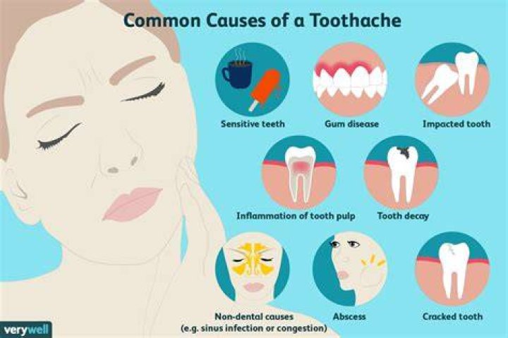 Can a toothache last for months?