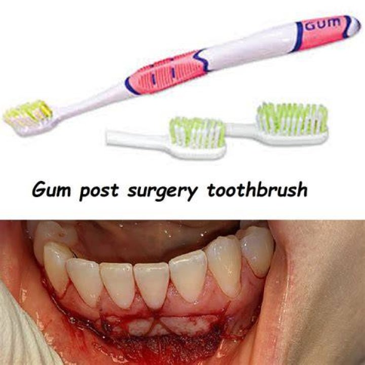 Can a toothbrush cut your gums?