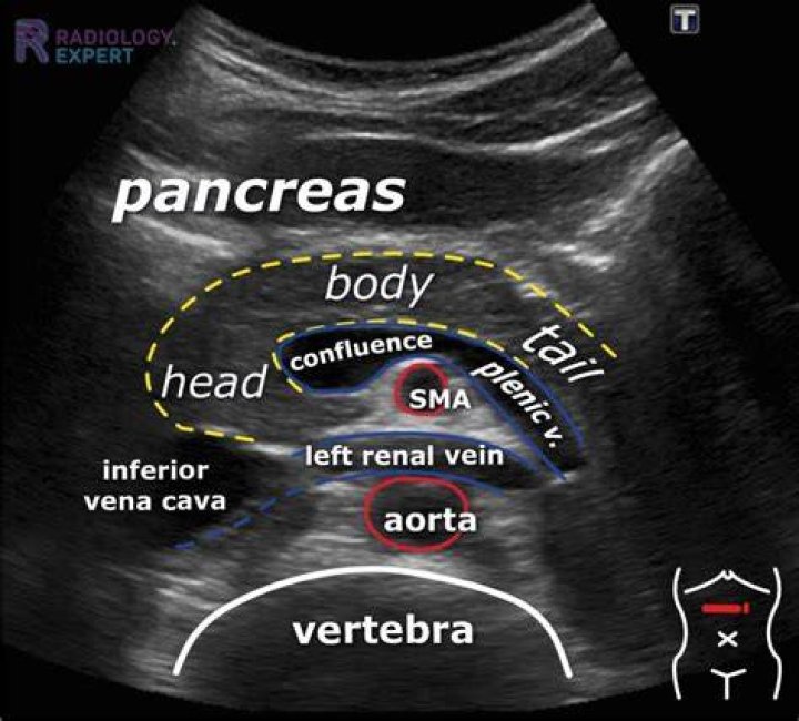 Can abdominal ultrasound see pancreas?