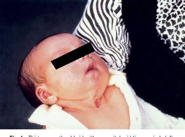Can babies be born with gills?