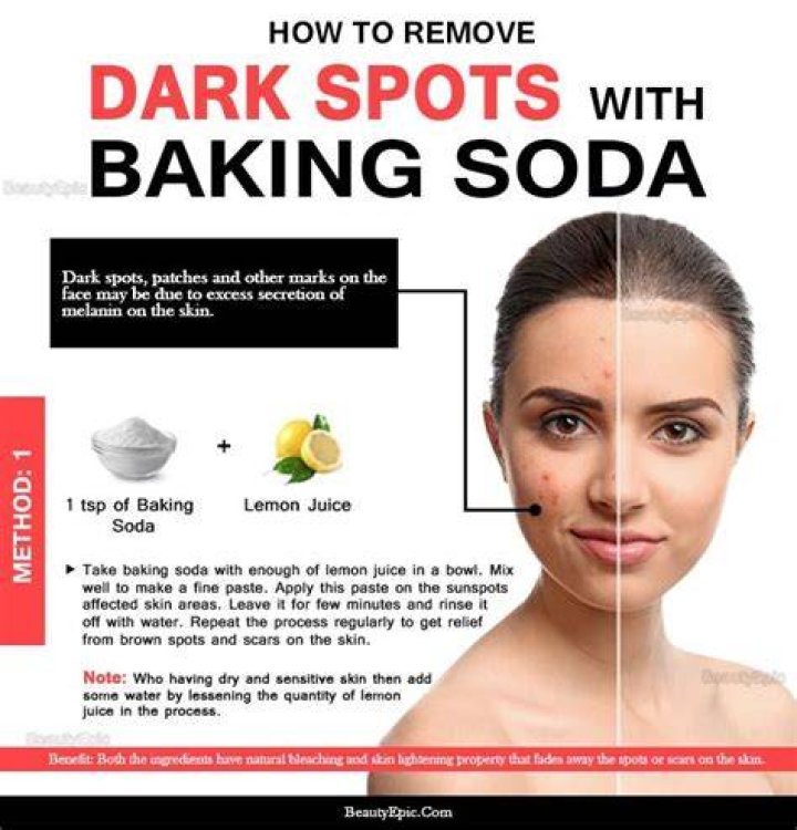 Can baking soda remove dark spots on legs?