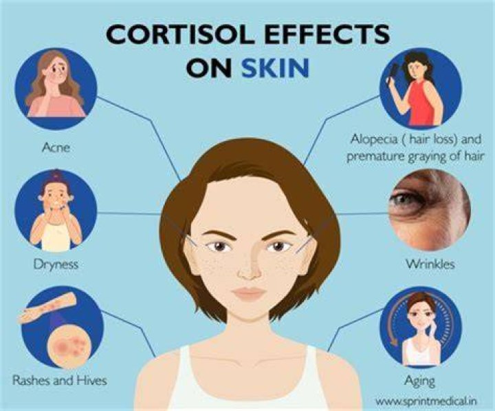 Can cortisol levels affect vision?