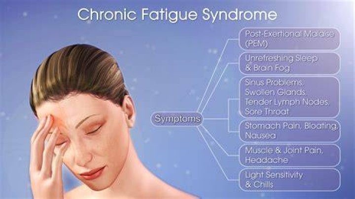 Can Covid cause chronic fatigue syndrome?