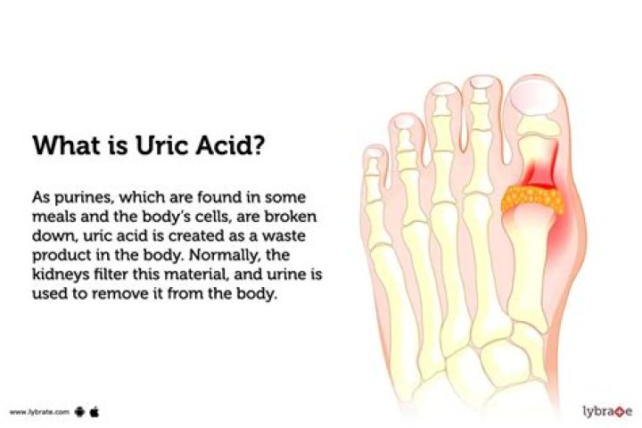 Can dal increase uric acid?