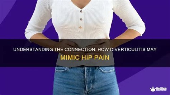 Can diverticulitis feel like hip pain?
