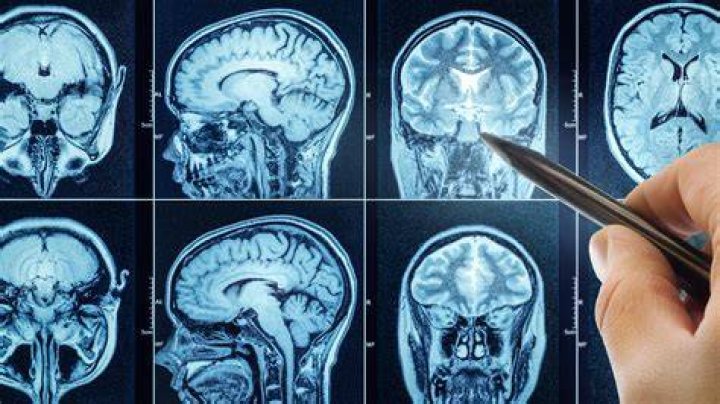 Can doctors check for brain damage?