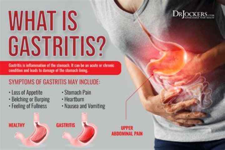 Can gastritis cause blood in stool?