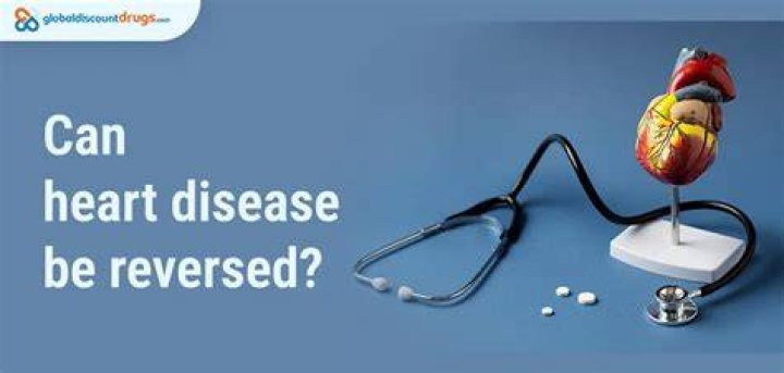 Can heart plaque reversed?