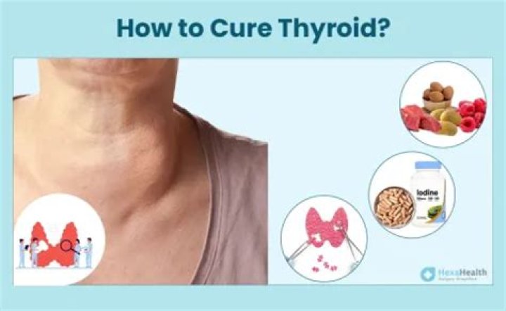 Can hypothyroidism be cured permanently?