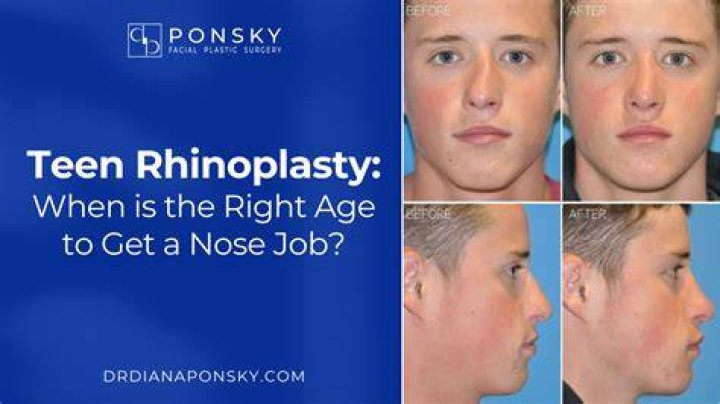 Can I get a nose job at 14?