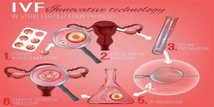 Can I get IVF if I am single?