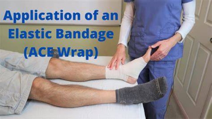 Can I use Ace bandage instead of compression stockings?