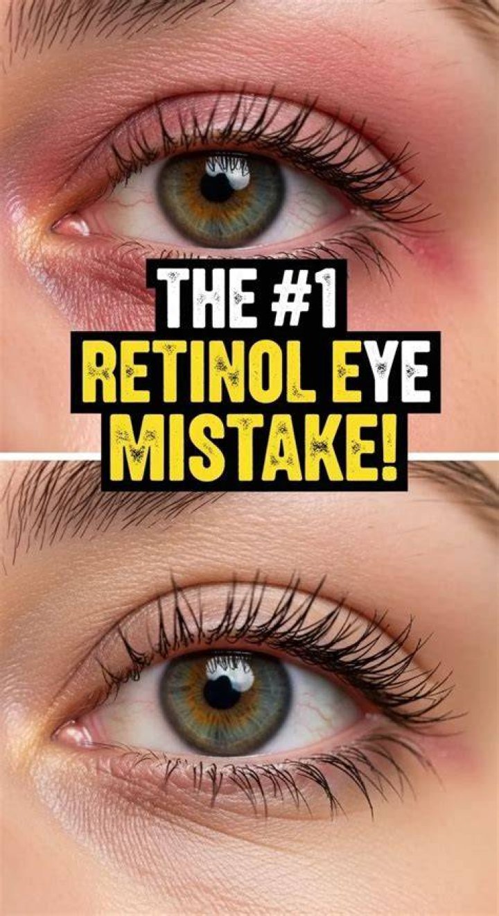 Can I use retinol under my eyes?