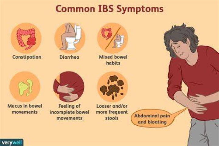 Can IBS start in your 30s?