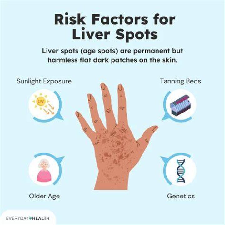 Can liver spots turn cancerous?