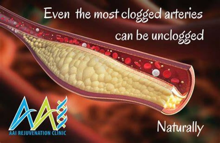 Can magnesium reverse hardening of the arteries?