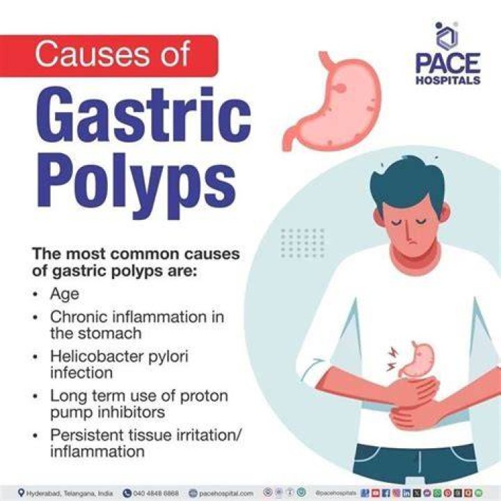 Can omeprazole cause polyps?