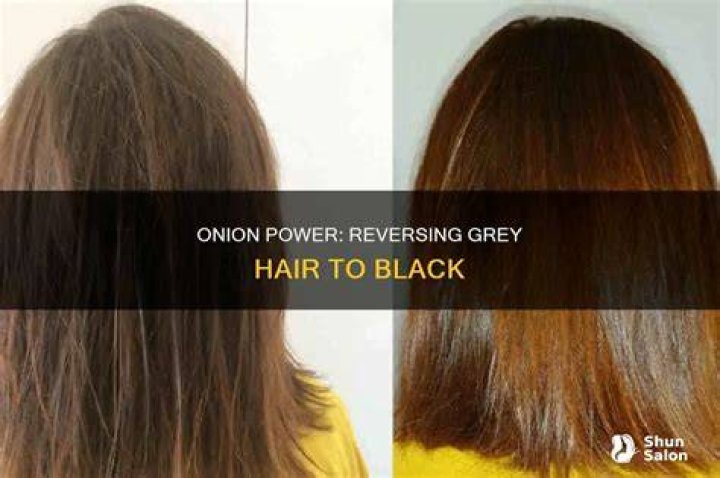 Can onion juice turn GREY hair black?