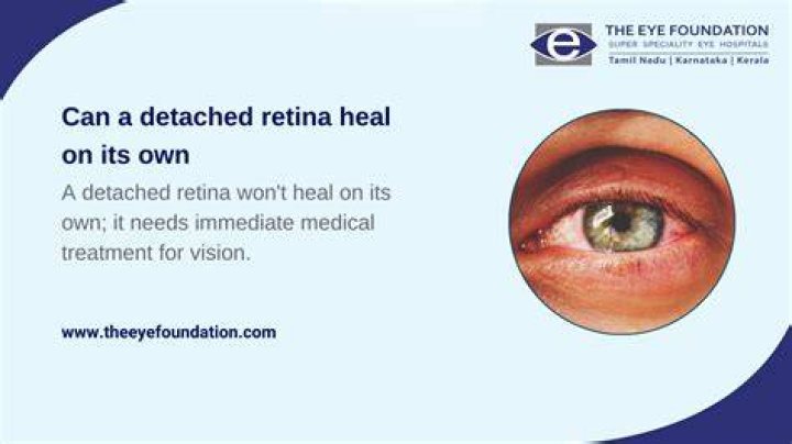 Can retina heal itself?