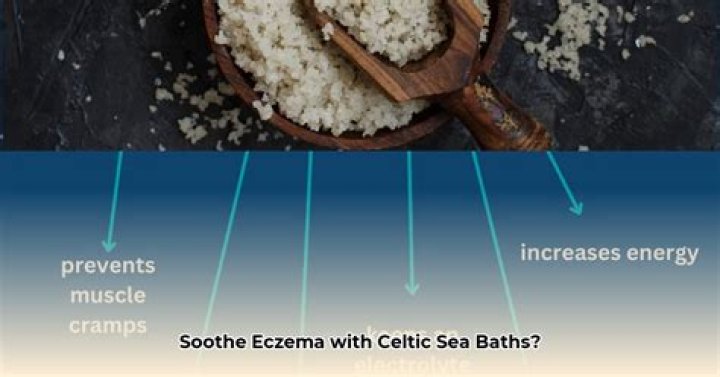Can salt cure eczema?