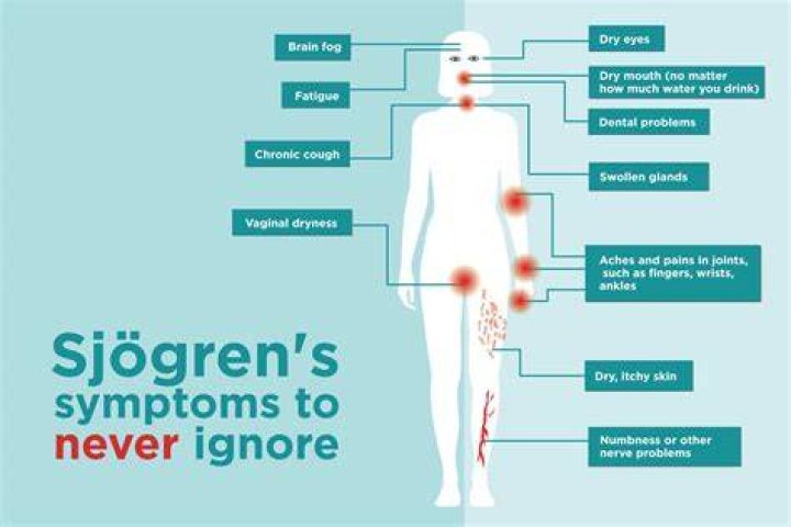 Can Sjögren's cause lupus?