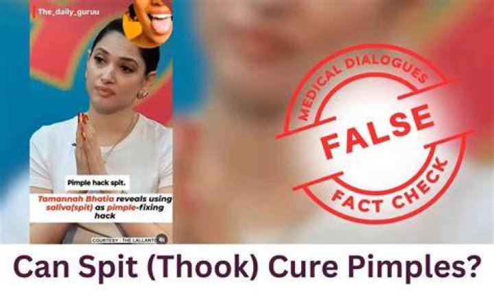 Can spit cure acne?