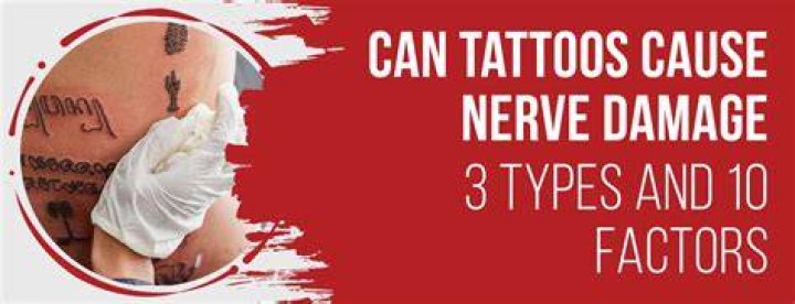 Can tattoos cause nerve damage?