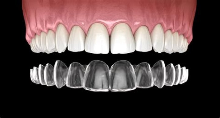 Can teeth be straightened at any age?