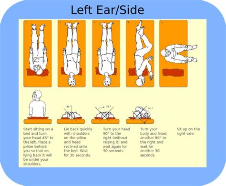 Can the Epley maneuver make you worse?