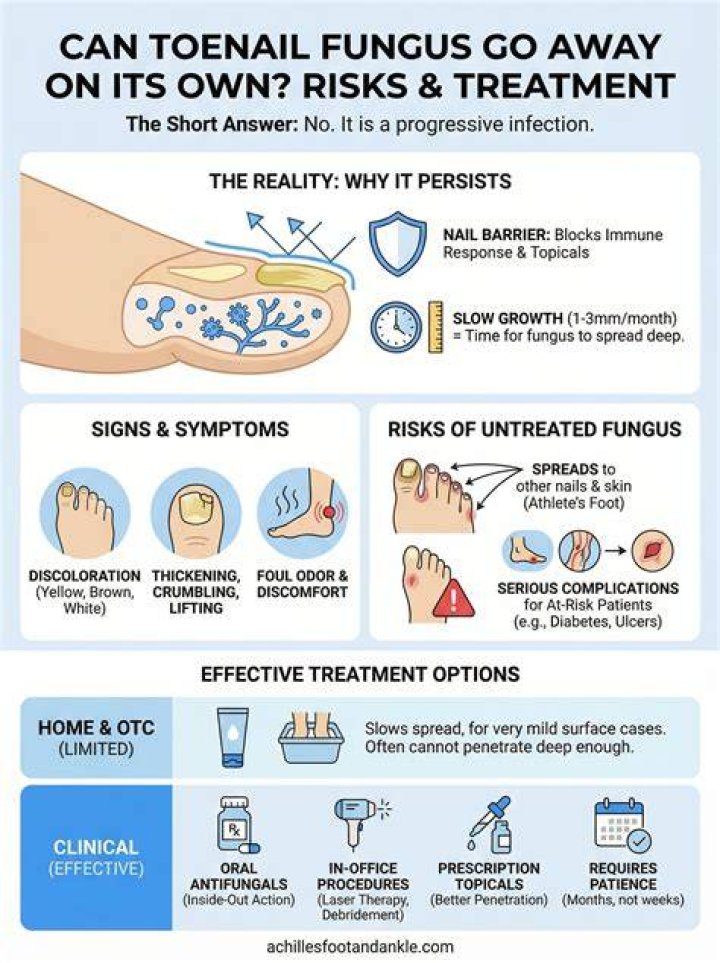 Can toenail fungus go away on its own?