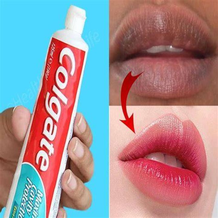 Can toothpaste make your lips dark?