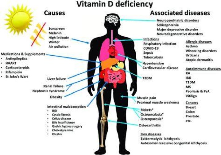 Can vitamin D deficiency cause nerves?
