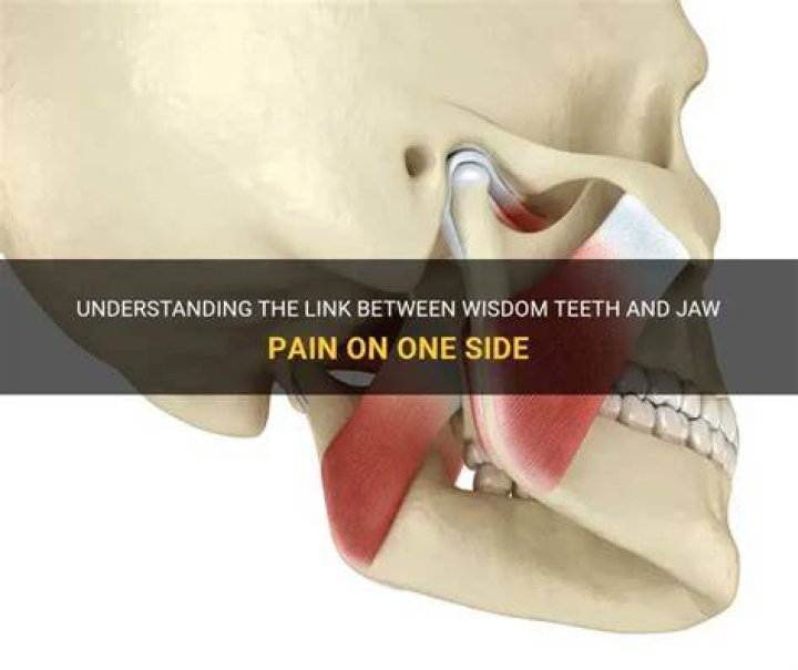 Can wisdom teeth cause jaw pain on one side?