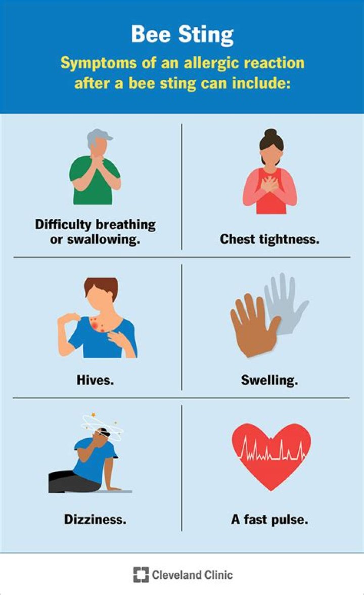 Can you become immune to bee stings?